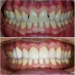 About Smiles Dental