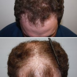 Tom Rosanelli, M.D. - Surgical restoration