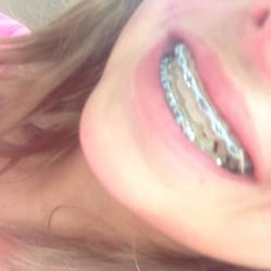 Summerland Dental - I love my braces :)