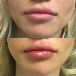 Face Fit Aesthetics