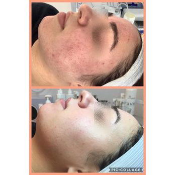 Starlight Med Spa - Starlight is known for "skin transformations" - Medical Spas Near Me - Vaughan, Ontario Starlight Med Spa - Starlight is known for "skin transformations" - Medical Spas Near Me - Vaughan, Ontario