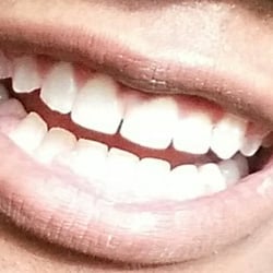 My Braces Doctor - After