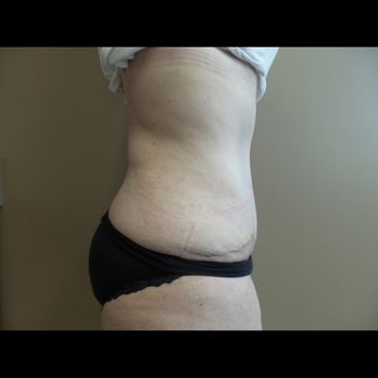 Valencia Plastic Surgery - Cosmetic Surgeons Near Me - Valencia, California