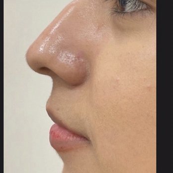 Vladimir Grigoryants, MD - Cosmetic Surgeons Near Me - Glendale, California Vladimir Grigoryants, MD - Cosmetic Surgeons Near Me - Glendale, California