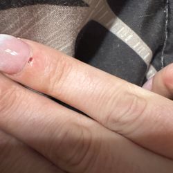 Rio Nail Bar - Cut me multiple times