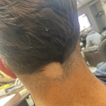 Matte Blvck - Two weeks after haircut and I still have razor burn - Barbers Near Me - San Diego, California Matte Blvck - Two weeks after haircut and I still have razor burn - Barbers Near Me - San Diego, California