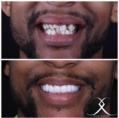 Before and After - Have you seen our before and after photos? We create smile transformations daily, but no two are alike.