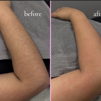 Sugar and Smooth Studio - Get The Best Smooth Skin Results With Sugaring ! - Sugaring Near Me - Pleasant Hill, California Sugar and Smooth Studio - Get The Best Smooth Skin Results With Sugaring ! - Sugaring Near Me - Pleasant Hill, California