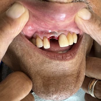 A Shop For Smiles - Ruben Mora DDS - before - Oral Surgeons Near Me - La Mesa, California A Shop For Smiles - Ruben Mora DDS - before - Oral Surgeons Near Me - La Mesa, California