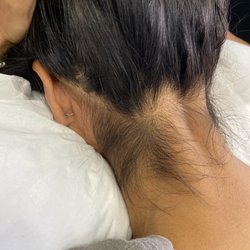 Xposed Waxing Salon - Before Neckline