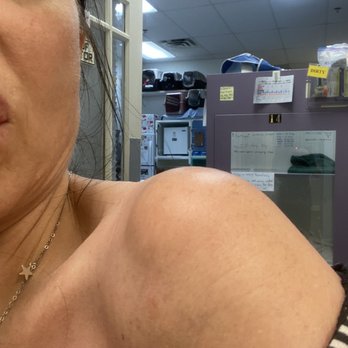 Albert Dabbah, MD - Lipoma - Cosmetic Surgeons Near Me - Boca Raton, Florida