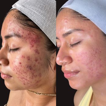 Skiniva Spa - Estheticians Near Me - Montebello, California Skiniva Spa - Estheticians Near Me - Montebello, California