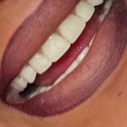 Today's Dental - Implants