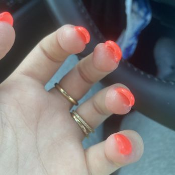 Allure Nails Spa - super thick and the acrylic is all over my skin - Nail Salons Near Me - Tavernier, Florida