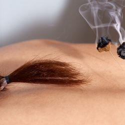 Acupuncture Liberté - Acupuncture