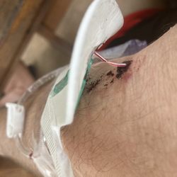 Lakeland Regional Health - PICC line