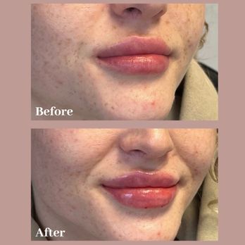 Beauty Lab - Medical Spas Near Me - Houston, Texas