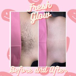 Fresh Glow Wax - A Brazilian wax before and after!