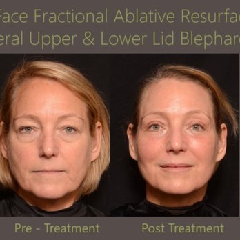 Brian S. Biesman, M.D - Cosmetic Surgeons Near Me - Nashville, Tennessee