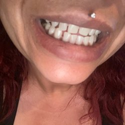 Tuscano Dental - He wanted me to get braces i said no ,he moved my teeth months later now I have a huge gap