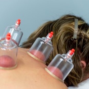 Discover Wellness - Cupping - Massage Therapy Near Me - Orillia, Ontario Discover Wellness - Cupping - Massage Therapy Near Me - Orillia, Ontario