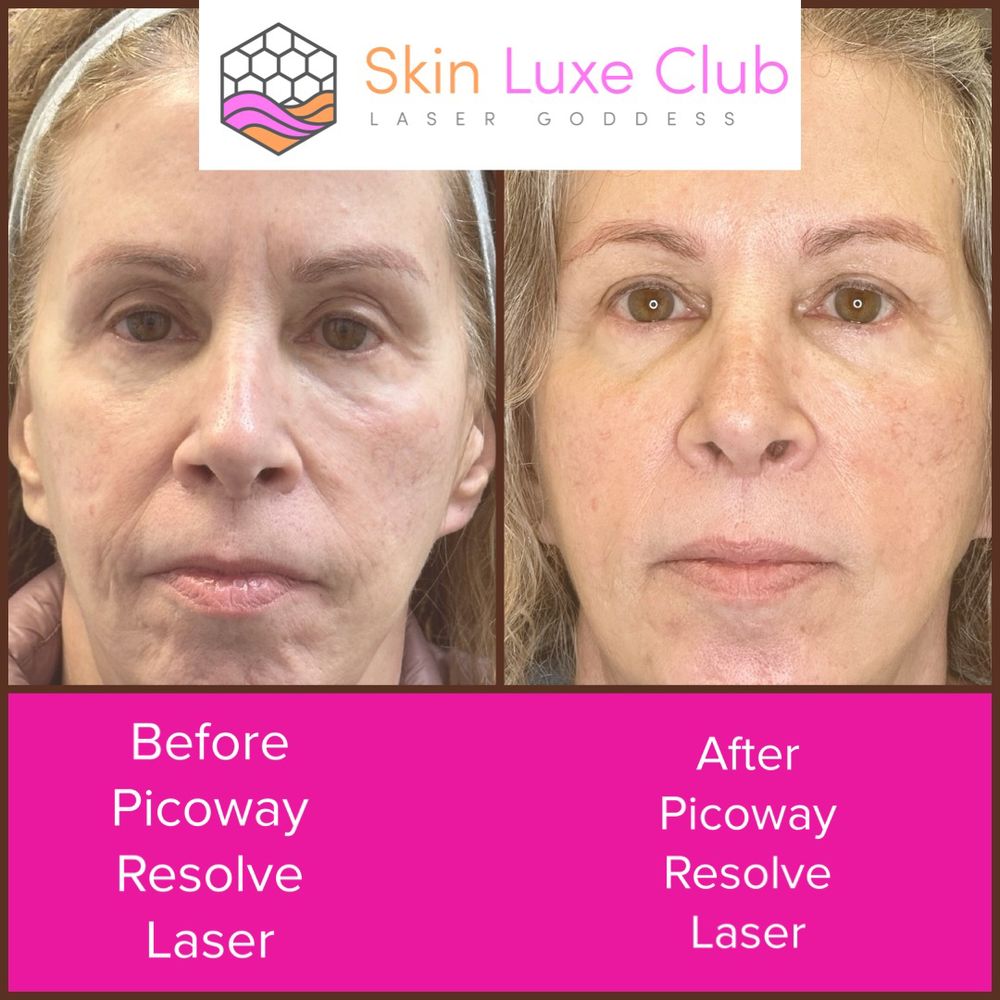 LASER GODDESS Updated September 2024 21 Photos & 35 Reviews 209