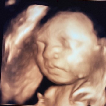 Picture Perfect 3D 4D - Ultrasound Imaging Centers Near Me - Houston, Texas Picture Perfect 3D 4D - Ultrasound Imaging Centers Near Me - Houston, Texas