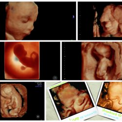 Exceptional Imaging Center - Exceptional Imaging Center