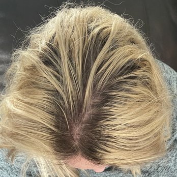 Brow Beauty Bar - After a month of grow but shows the lack of high/low lights. Just bleach to crap on top. - Acne Treatment Near Me - Green Bay, Wisconsin