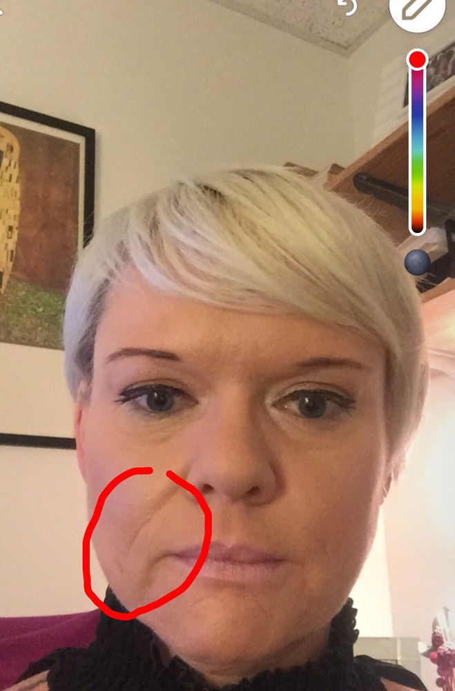 Dermatology Laser Center At MGH