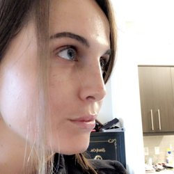 Pestana Ivo D, MD - I got a rhinoplasty from Dr. Pestana only a few months ago and my results are incredible.