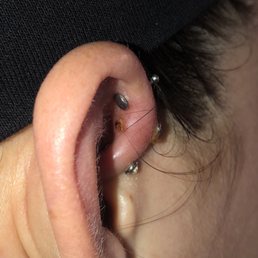 Infected tapered ear Infected tapered ear