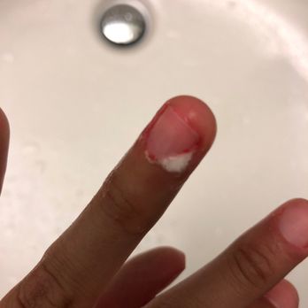 Nail Port - When I poured peroxide on it. - Nail Salons Near Me - Fort Lauderdale, Florida Nail Port - When I poured peroxide on it. - Nail Salons Near Me - Fort Lauderdale, Florida