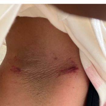 Tones Day Spa - Hair Removal Near Me - The Bronx, New York