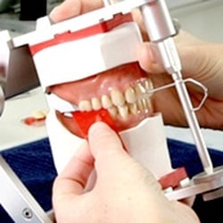 David Gelman's Dental Laboratory Inc - High end removable knowledge