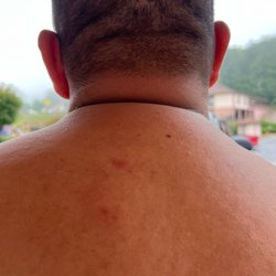 Mountain Valley Inn - The bite marks