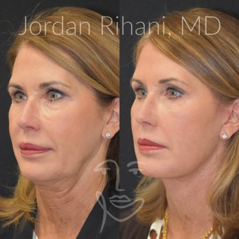 Facial Plastic Surgery Institute - Plastic Surgeons Near Me - Southlake, Texas Facial Plastic Surgery Institute - Plastic Surgeons Near Me - Southlake, Texas