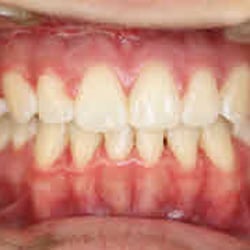 Newman Orthodontics - After