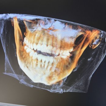 LA Smile Specialists - My 3D X-ray - Cosmetic Dentists Near Me - Beverly Hills, California LA Smile Specialists - My 3D X-ray - Cosmetic Dentists Near Me - Beverly Hills, California
