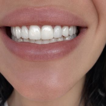 Kool Dentistry - Cosmetic Dentists Near Me - Glendale, California