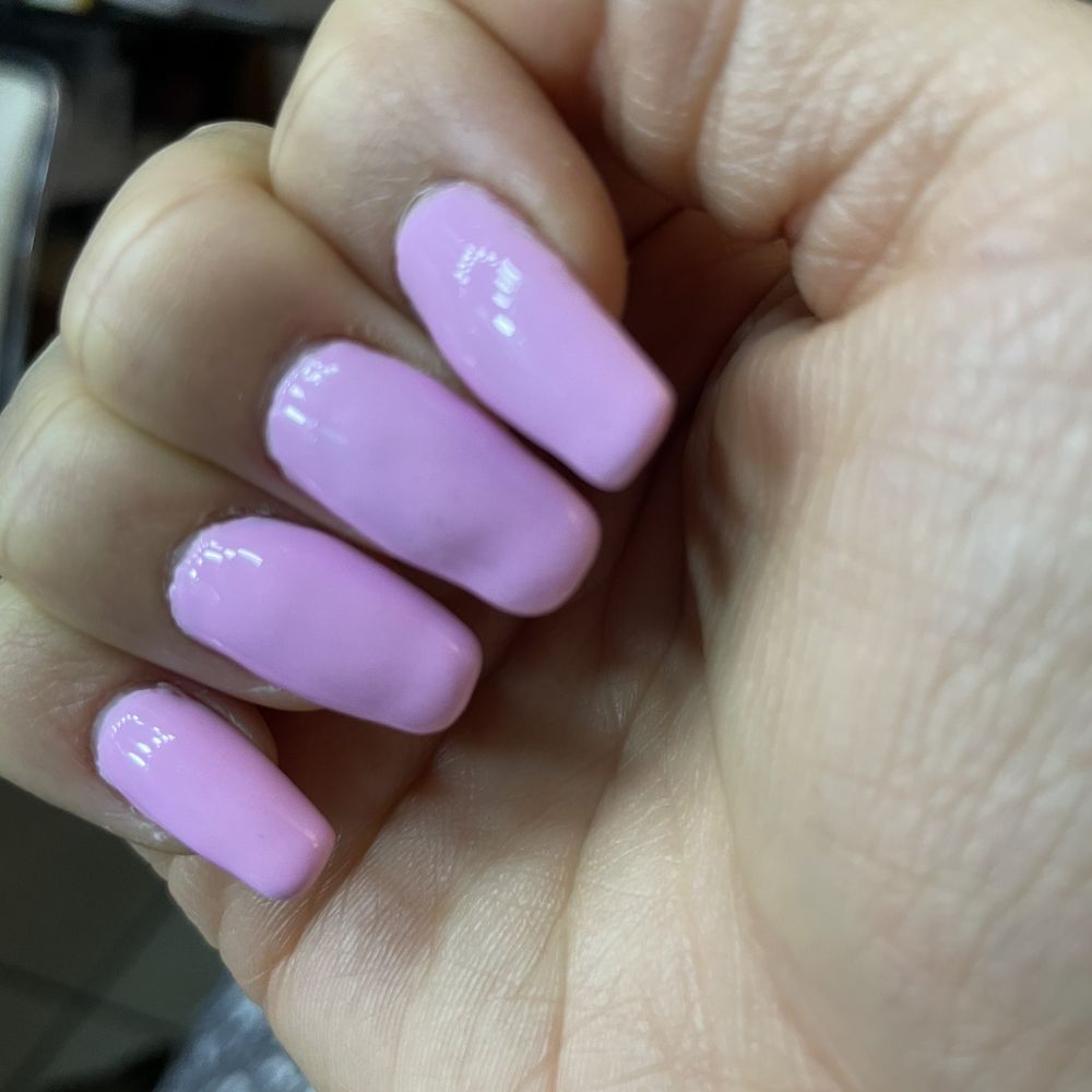 Nails bumpy Nails bumpy