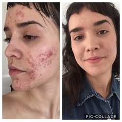 Advanced Skin Care Solutions