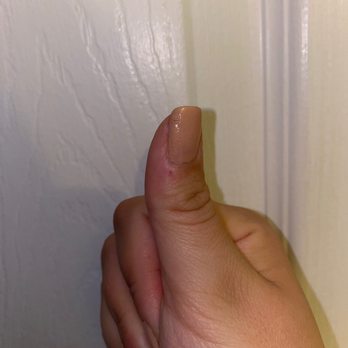 U V Nails & Spa - Bubbles in thumbnail and gouge that happened 8 hours later bc the polish was so thick it still wasn't dried properly. - Nail Salons Near Me - Cameron, North Carolina U V Nails & Spa - Bubbles in thumbnail and gouge that happened 8 hours later bc the polish was so thick it still wasn't dried properly. - Nail Salons Near Me - Cameron, North Carolina