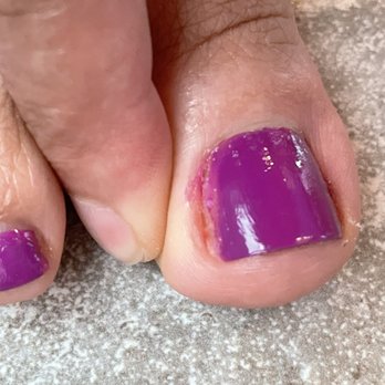 Enjoy Nails & Spa - Bad polish job on large toe and some blood from cutting away ingrown nail. - Nail Salons Near Me - Austin, Texas