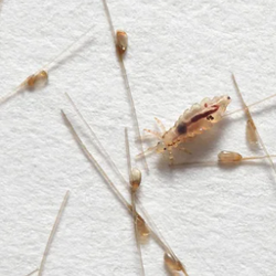 Nits Lice eggs and one male adult lice bug