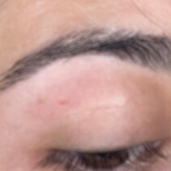 Zia Threading - Skin ripped