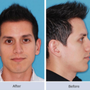 Photo of Corinne E. Horn, MD - NY Facial Plastics