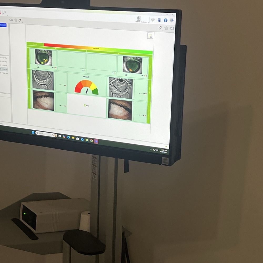 Stephen Moffett, OD - Coronado Eye Care Optometry - Dry eye evaluation - Optometrists Near Me - Coronado, California Stephen Moffett, OD - Coronado Eye Care Optometry - Dry eye evaluation - Optometrists Near Me - Coronado, California