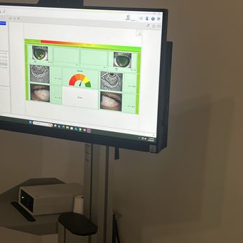 Stephen Moffett, OD - Coronado Eye Care Optometry - Dry eye evaluation - Optometrists Near Me - Coronado, California Stephen Moffett, OD - Coronado Eye Care Optometry - Dry eye evaluation - Optometrists Near Me - Coronado, California