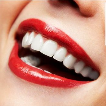 Whitenex Cosmetic Teeth Whitening - Whitenex has move to a new location in 512 W Balboa Blvd, Newport Beach, CA - Teeth Whitening Near Me - Costa Mesa, California Whitenex Cosmetic Teeth Whitening - Whitenex has move to a new location in 512 W Balboa Blvd, Newport Beach, CA - Teeth Whitening Near Me - Costa Mesa, California